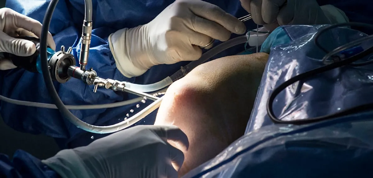 Post-Surgery Revolution: Patients Recover Rapidly with Fast-Track Method
