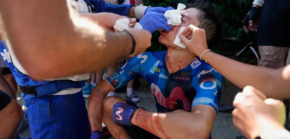 Tour de France 2026 Tragedy: Rubio Collides with Support Vehicle on Alpe d'Huez