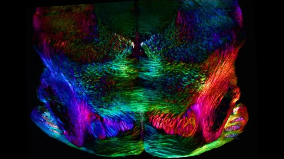 Childhood Trauma: Permanent Brain Scars, Lifelong Depression Gateway?