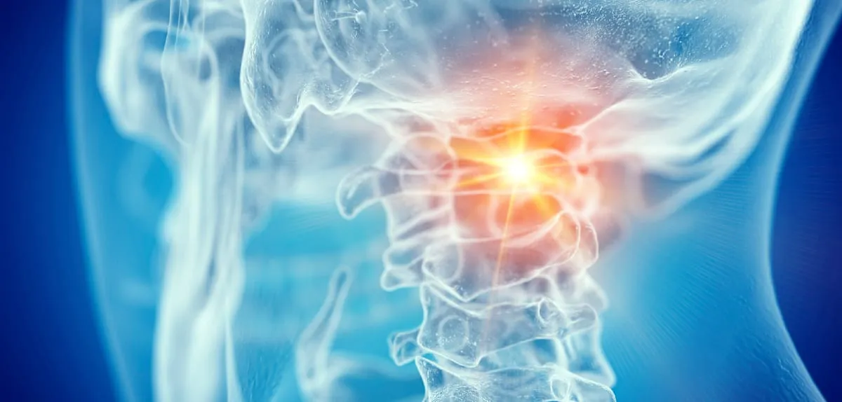 Chronic Neck Pain and Dizziness: Who Holds the Truth?